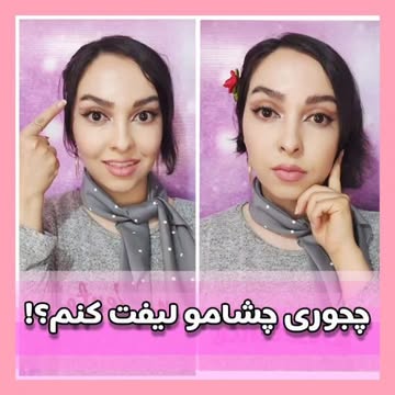 کش لیفت شقیقه